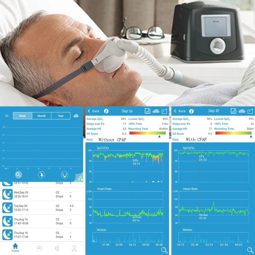 Manufacture Price Wrist Sleep Wireless Oximeter with PC Report Continuous Pulse Monitor with CE&FDA